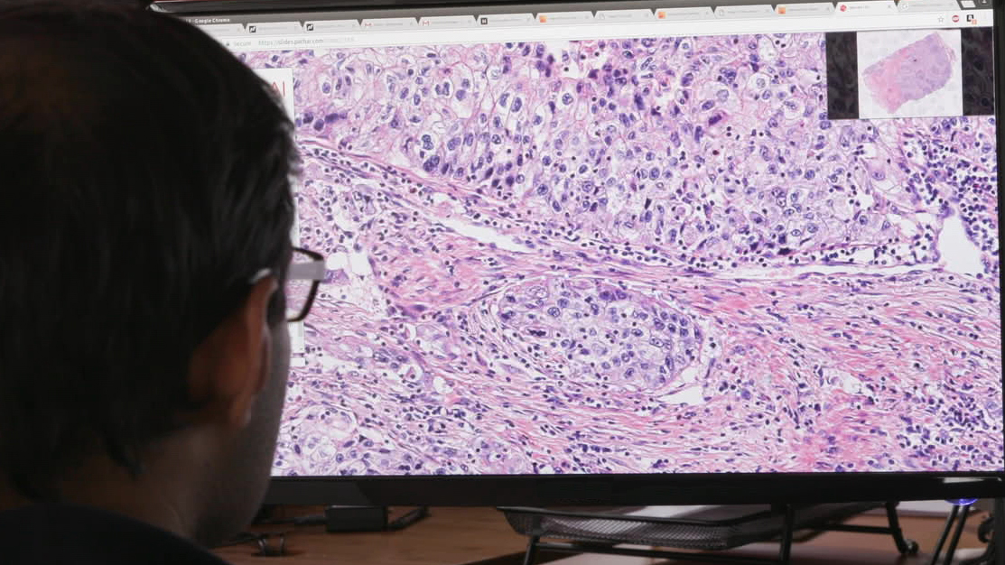 Computerpathologie-Startup erhält 60Mio.$