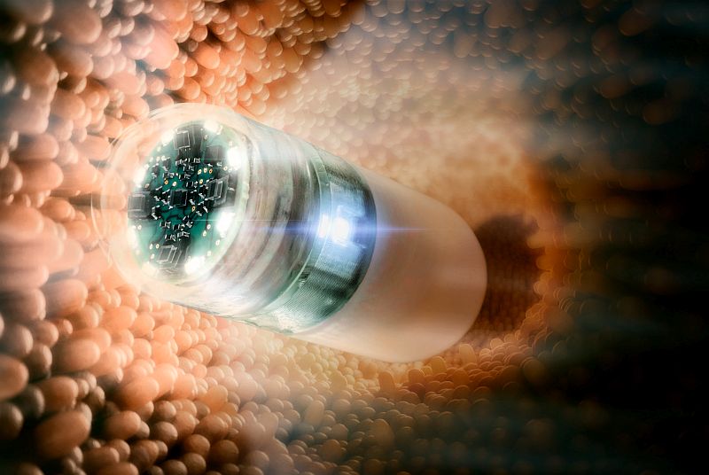 Schnellere Dünndarmdiagnose dank Kamerapille