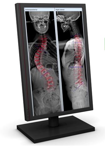 EOS imaging Übernahme geplatzt