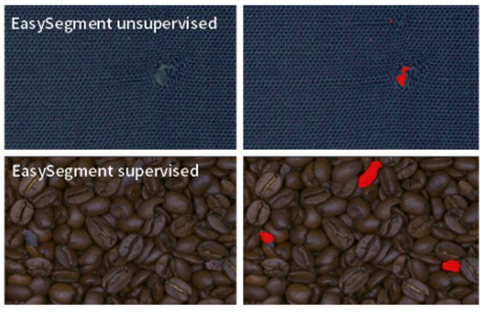 Supervised DeepLearning-Segmentierung