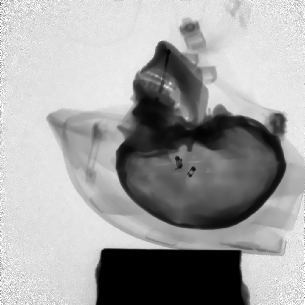 Highspeed X-ray