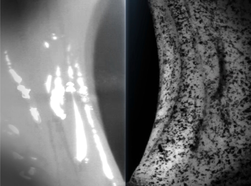 Bild 2 | Aufnahme des Schwingverhaltens von Stimmbändern: starke Reflexionen bei Weißlicht (l.); Fluoreszenzfarbe grundiert und Pulver bespecklet (r.).