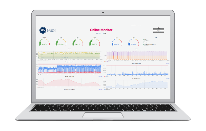 Drahtlose Drehmomentüberwachung 6 Drahtlose Drehmomentüberwachung