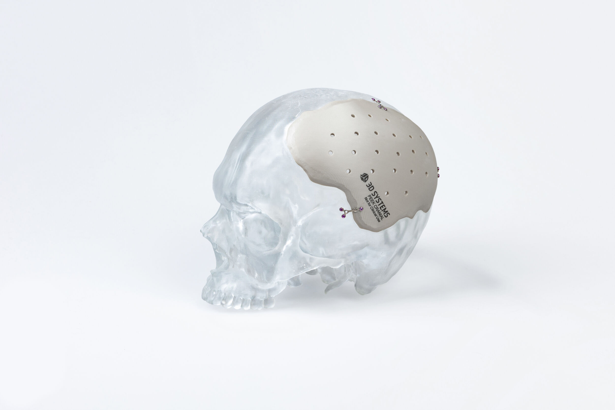 3D-Druck in der Medizin und darüber hinaus